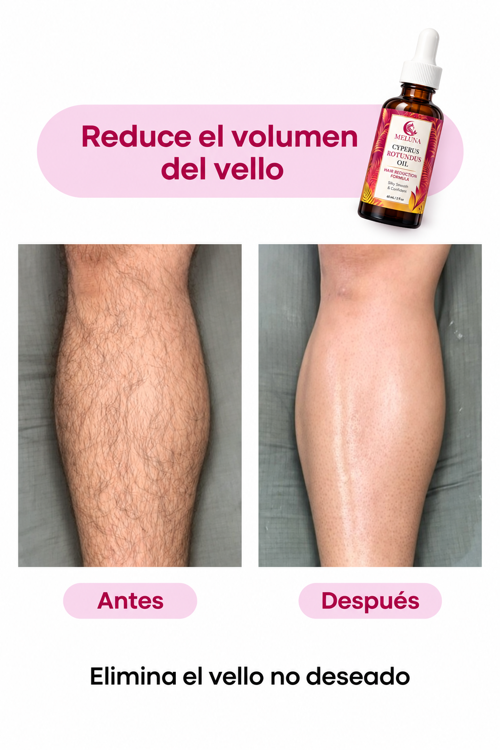 Sérum Reductor de Vello Meluna